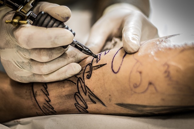 odstranění tetování